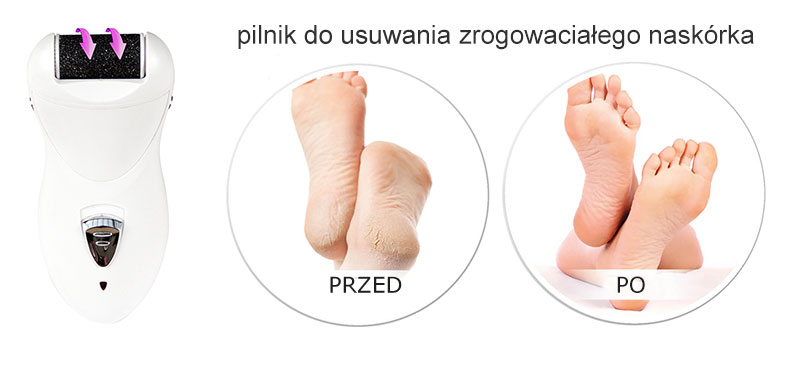 Golarka, depilator i pilnik w jednym
